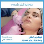 کلینیک بین المللی پوست مو زیبایی بهمن یار کرمان-آنچه در مورد تزریق ژل نمیدانید